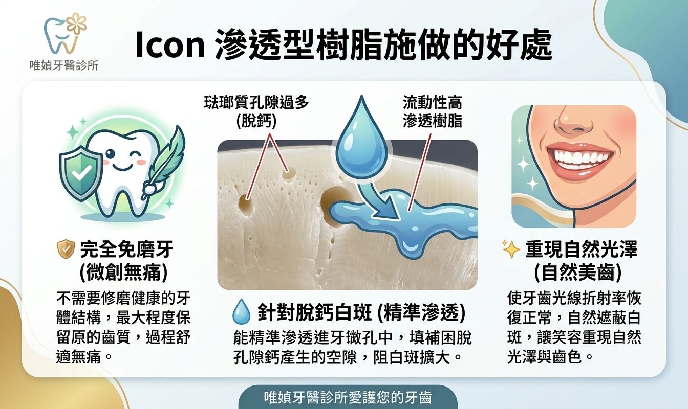 Icon Infiltration Resin therapy滲透型樹脂修復